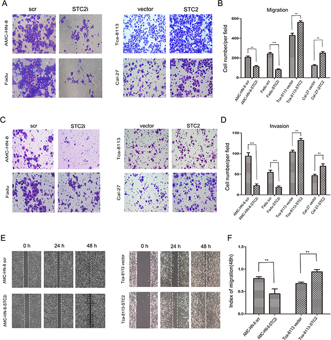 STC2 strengthens HNSCC cell migration, invasion, and tumor metastasis.
