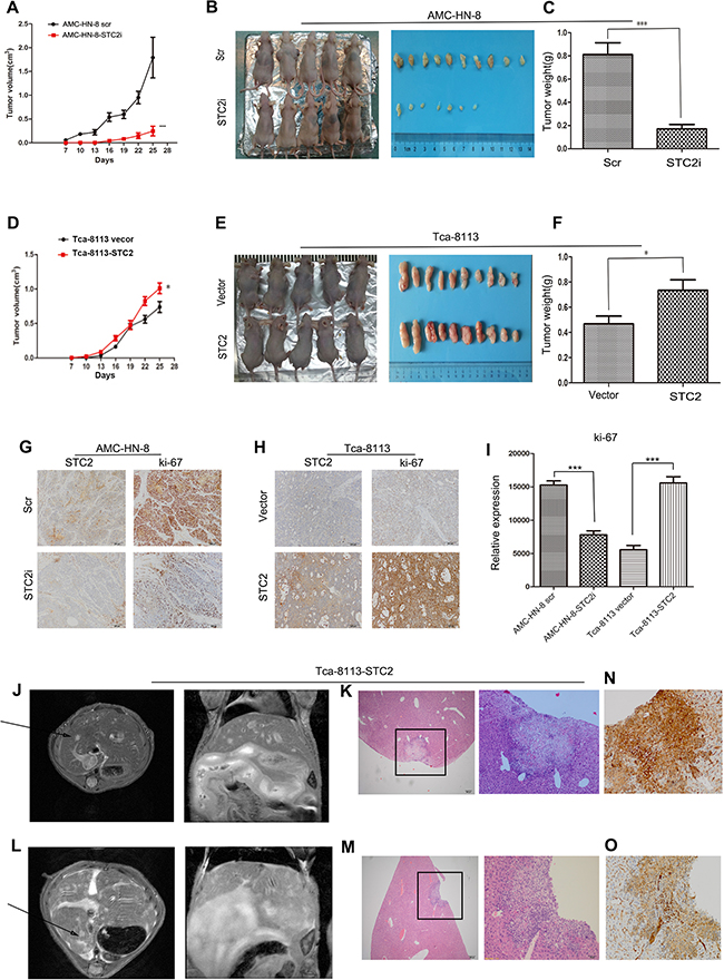 STC2 promotes the growth of HNSCC and tumor metastasis in vivo.