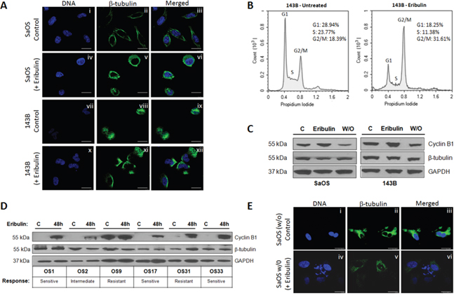 Microtubule disruption and &#x03B2;-tubulin aggregate accumulation induce expression of cell cycle regulators in osteosarcoma cell lines and xenograft tumors.