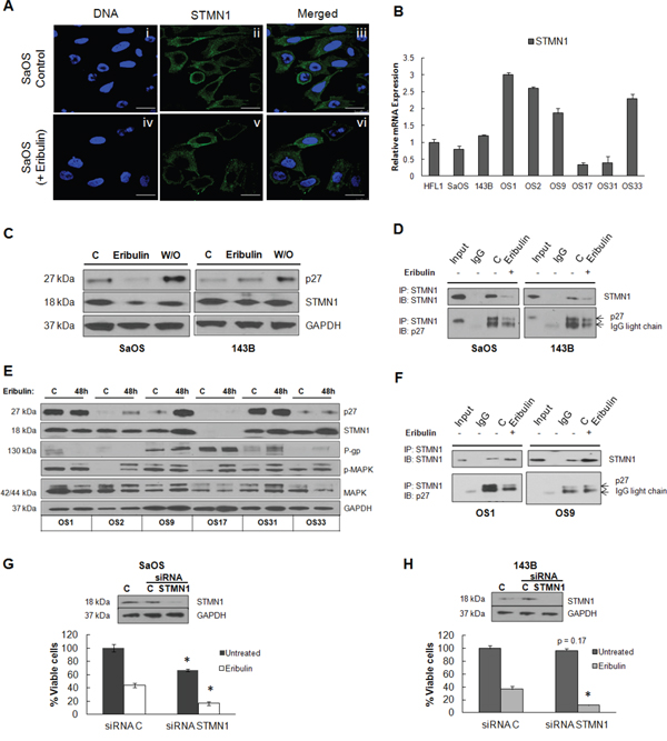 STMN1 expression and association with p27.