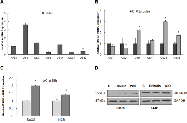 &#x03B2;III-tubulin expression in osteosarcoma cell lines and tumors.
