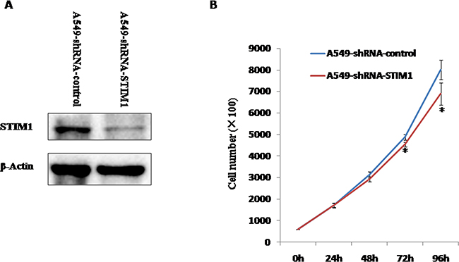 The silencing efficiency of STIM1 in A549 cells and the effects of silencing STIM1 on A549 cell proliferation.