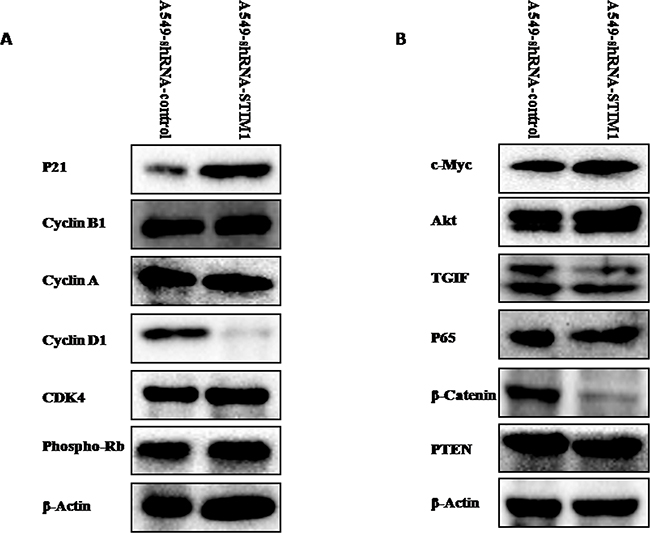 Effects of silencing STIM1 on the expression of several proteins.