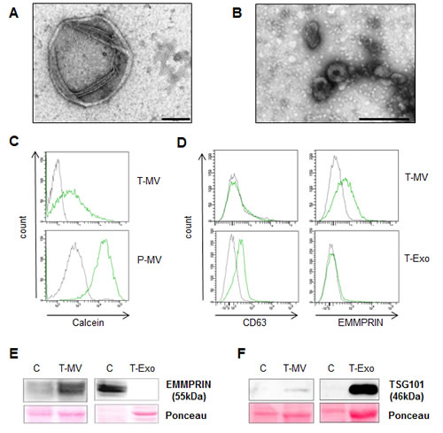 MV and Exo are distinct vesicle populations.