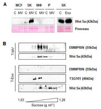 Wnt 5a is also exported on MV and Exo of SK-BR-3 cells.