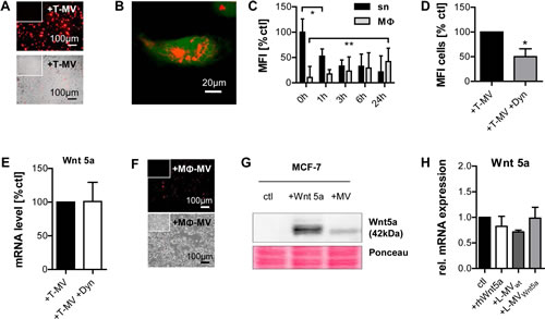 MV are mutually incorporated by M&#x3a6; and tumor cells.