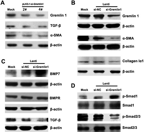 Knockdown of gremlin1 expression modulates BMP-7/TGF-&#x03B2; signaling leading to suppression of HSC activation.