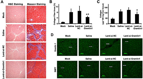 siRNA-mediated downregulation of gremlin1 expression alleviates hepatic fibrosis in a SD rat model.