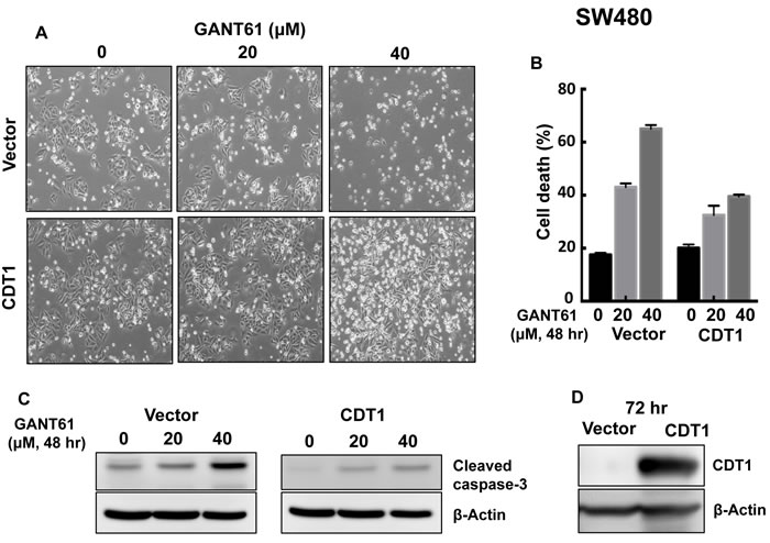 CDT1 overexpression in SW480 cells and treatment with GANT61 were conducted as described in the legend to Figure 9.