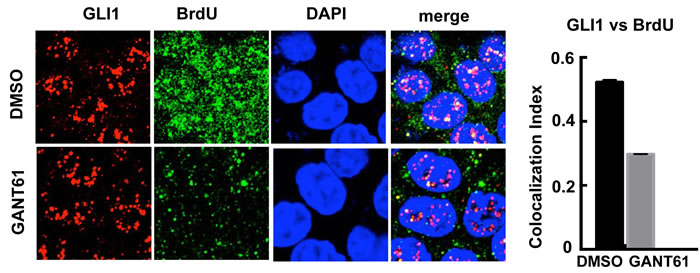 Confocal microscopy of GLI1 expression