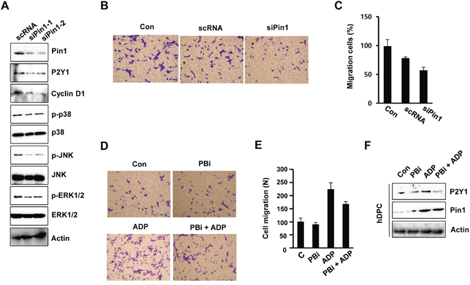 Pin1 depletion inhibits MAPK phosphorylation and cell migration.