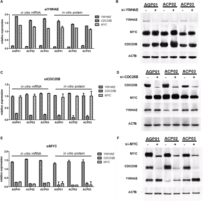Effect of gene silencing in gene and protein expression in gastric cancer cell lines.