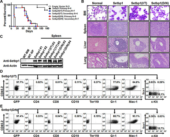 Setbp1 missense mutations induces AML development.