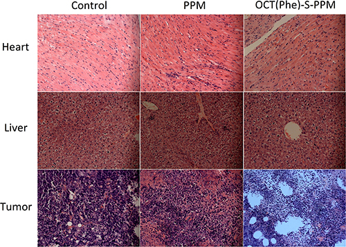 Typical histopathologic images of rat hearts, livers and tumors after treatment in H22-bearing mice with PPM and OCT(Phe)-S-PPM for ten days (HE staining, &#x00D7;20).