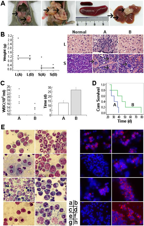 RNTS suppresses Bcr-Abl oncogenicity in mice.