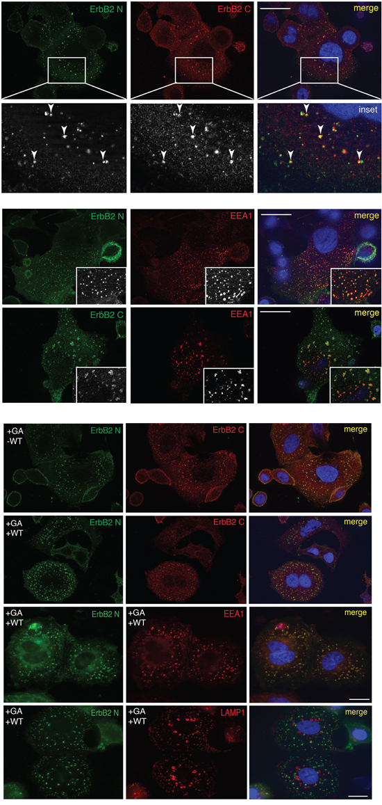 The full-lenght ERBB2 is trafficked to EEA1-positive compartments upon GA.