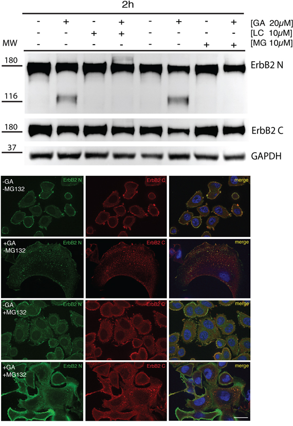 Proteasome is responsible for the generation of p116-ERBB2 under GA.