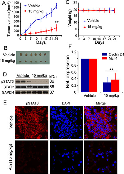 In vivo therapeutic efficacy of Atn on human TNBC murine models.