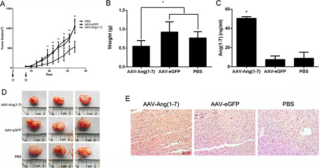 Ang-(1-7) inhibits lung tumor growth.