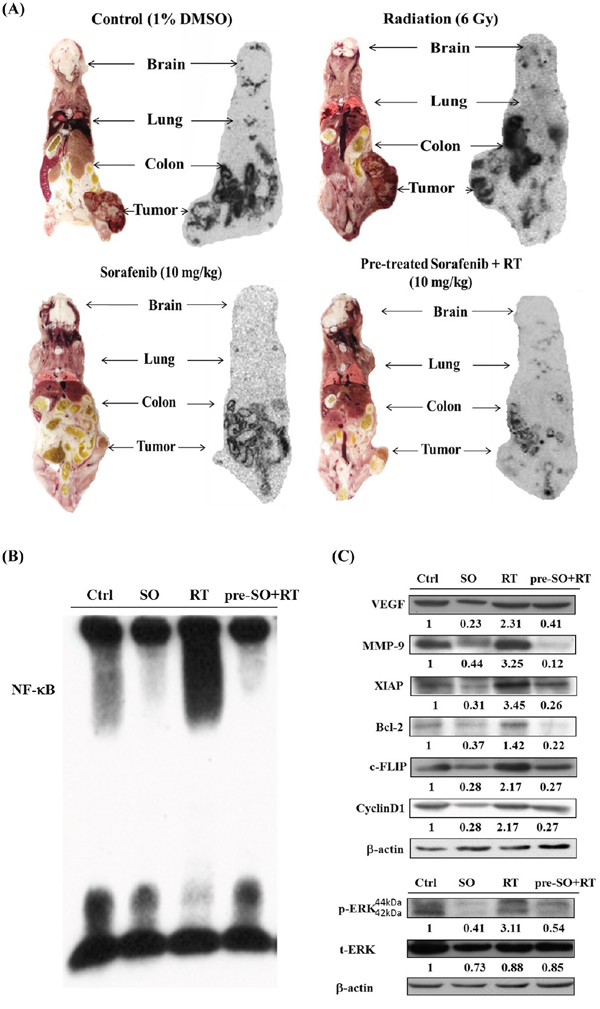 NF-&#x03BA;B activity and its downstream proteins are suppressed by pretreatment of sorafenib plus radiation.