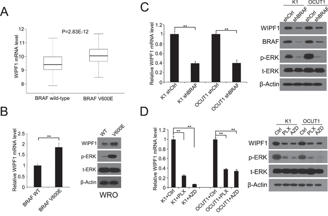 BRAF V600E upregulates WIPF1 expression in thyroid cancer tumor and thyroid cancer cells.