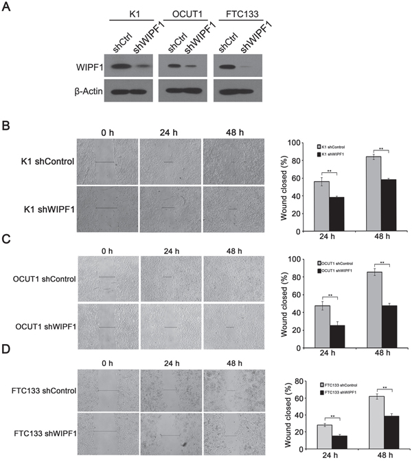 Knockdown of WIPF1 inhibits thyroid cancer cell migration.
