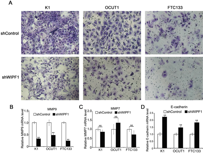 Knockdown of WIPF1 inhibits thyroid cancer cell invasion.