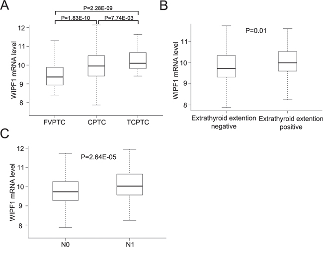 Overexpression of WIPF1 is associated with poor clinicopathological outcomes of PTC in TCGA database.