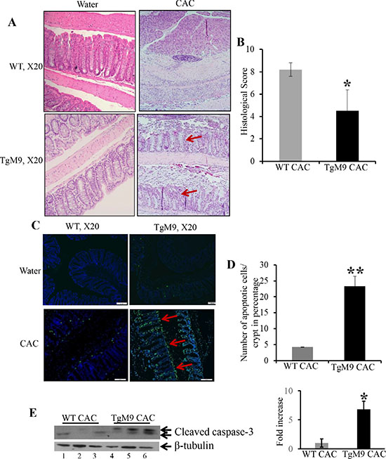 Constitutive expression of MMP9 in colonic epithelium was associated with lower histological score and apoptosis in CAC.