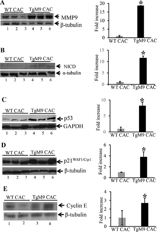 TgM9 mice exhibited altered protein expression of NICD, p53, p21 WAF1/Cip1 and Cyclin E.