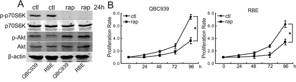 Rapamycin inhibits the proliferation of human CCA cells.