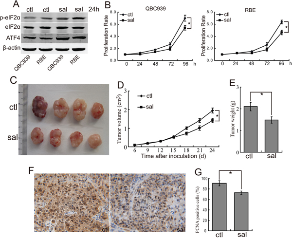 Salubrinal inhibits the proliferation of human CCA cells in vitro and in vivo.