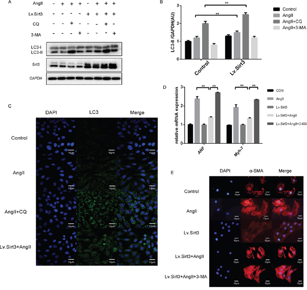 Sirt3 overexpression triggers autophagy in H9C2 cells.