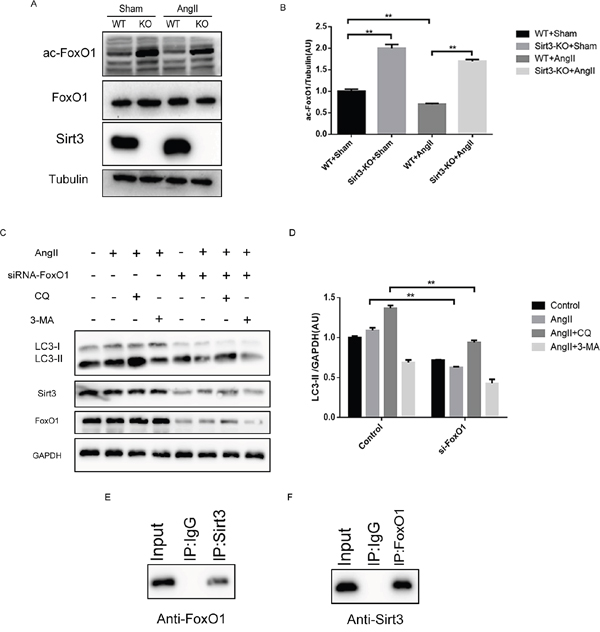 Sirt3 controls the acetylation status of FoxO1.