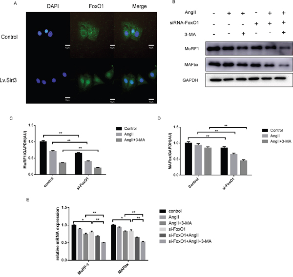 Sirt3 promotes the nuclear translocation and transcriptional activity of FoxO1.
