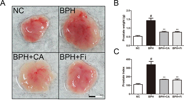 Effect of CA on prostate weight and prostate index in TP-induced BPH rats.
