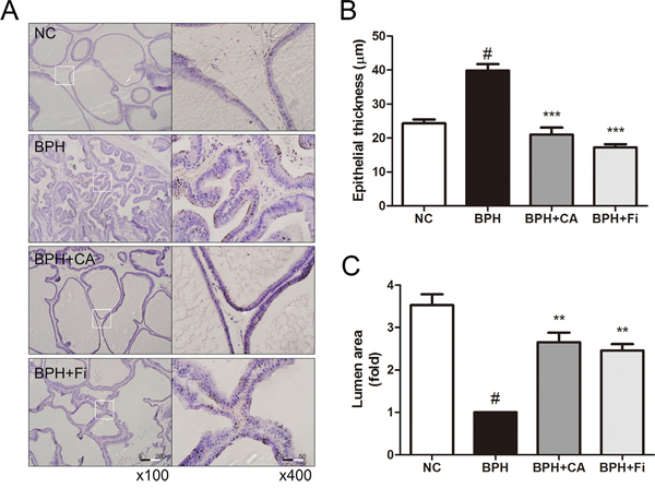 Effect of CA on histological changes of the prostate tissues in TP-induced BPH rats.