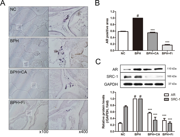 Effect of CA on AR and its coactivator SRC1 in the prostate tissues of TP-induced BPH rats.