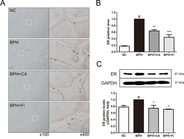 Effect of CA on ER&#x03B1; in the prostate tissues of TP-induced BPH rats.