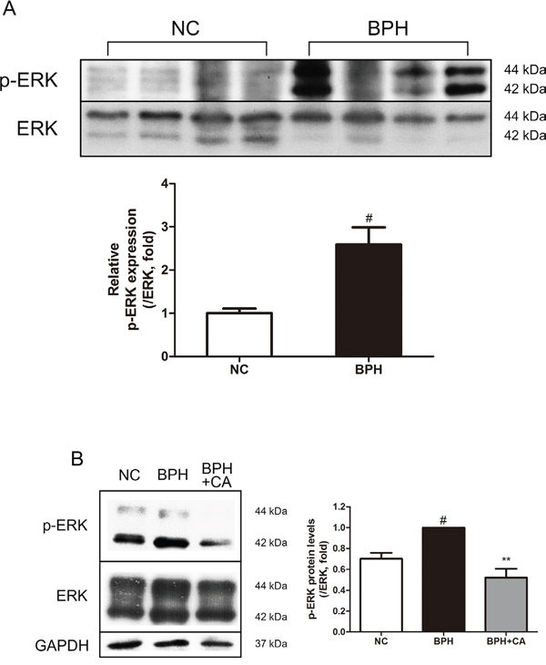 Effect of CA on ERK in the prostate tissues of TP-induced BPH rats.