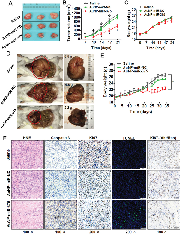 Anti-tumor effects of AuNP-miR-375 in xenograft and primary HCC mouse models.