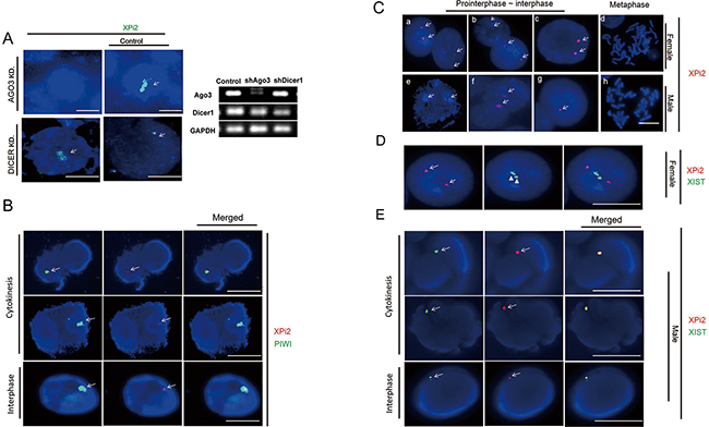 The relationships between XPi2, PIWIL1, and XIST were explored, respectively.