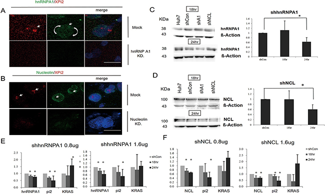 Knockdown of either hnRNP A1 or nucleolin disrupted the XPi2-nucleolin-hnRNP A1 complex.