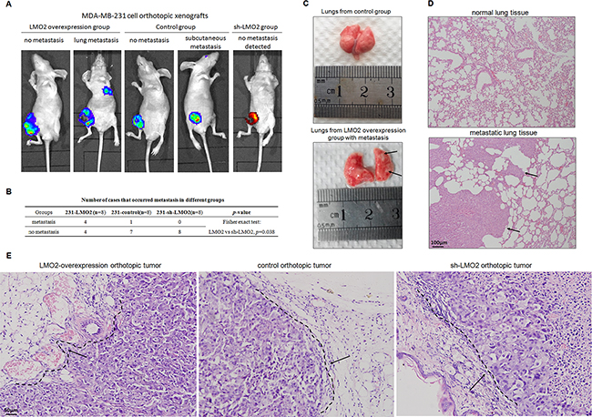 LMO2 promoted in vivo invasiveness and distant metastasis of basal-type breast cancer cells in orthotopic xenograft SCID mice.