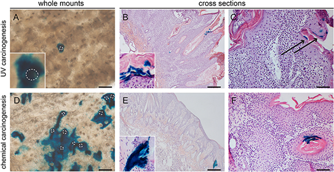 Lgr6 progeny in inter-tumoral skin and skin tumors of hairless mice.