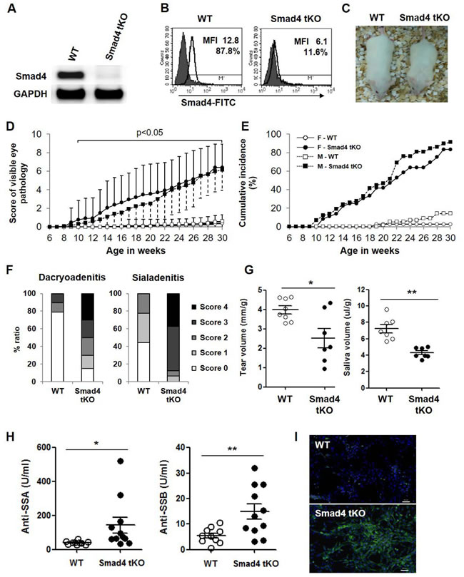 T cell-specific Smad4 deficiency increases the incidence of SS and accelerates disease onset in NOD mice.