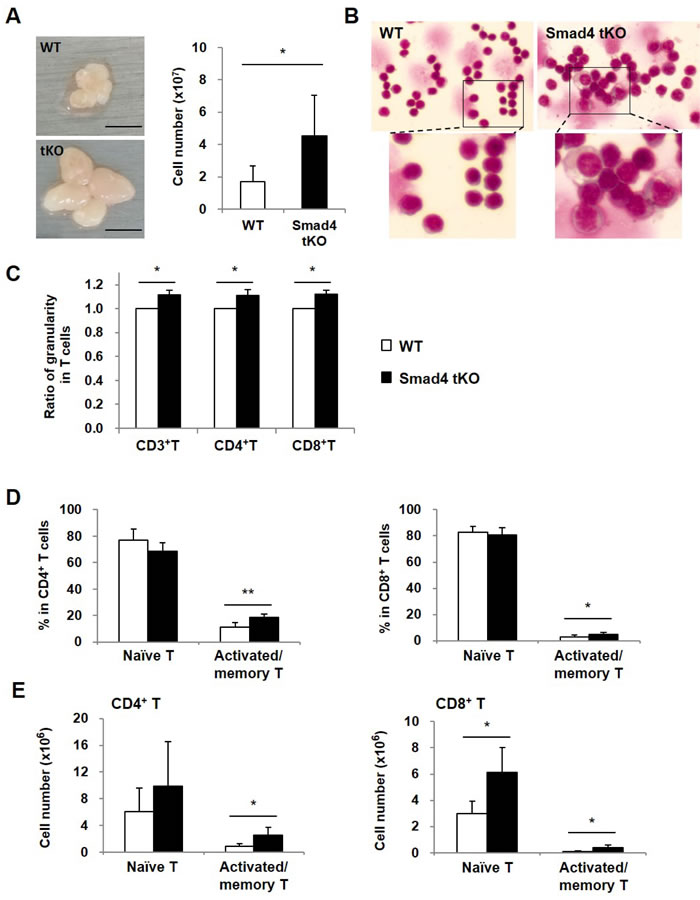 Cellular granularity and activated/memory T cells are increased in SLCs from Smad4 tKO NOD mice.