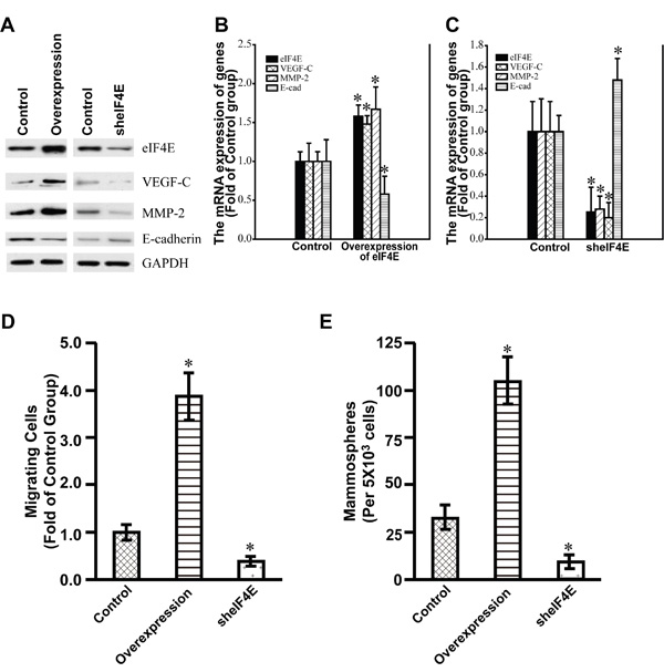 The expression of VEGF-C, MMP-2 and E-cadherin in the stable SW480 cell lines with the overexpression and Knockdown of eIF4E.