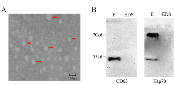 Characterization of serum exosome.