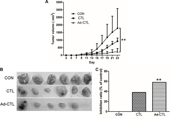 Ad5/35-TRAIL-CD40L-CTL (Ad-CTL) inhibits pancreatic carcinoma growth in vivo.